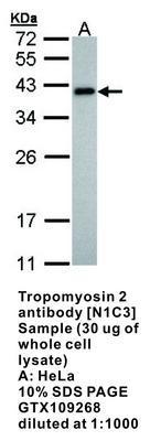 Tropomyosin 2 antibody [N1C3], GeneTex