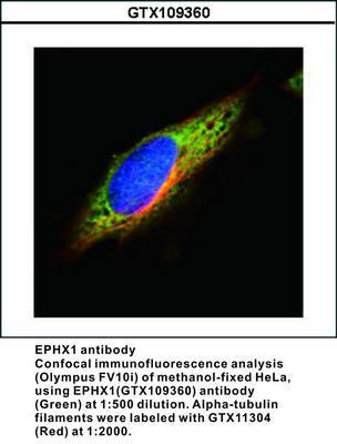 EPHX1 antibody (aa 1-223), GeneTex