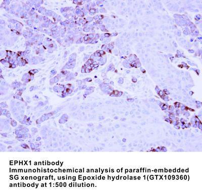 EPHX1 antibody (aa 1-223), GeneTex