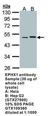 EPHX1 antibody (aa 1-223), GeneTex