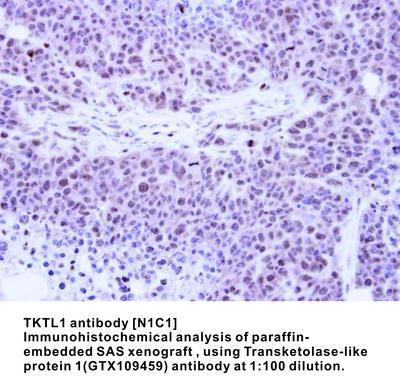 TKTL1 antibody [N1C1], GeneTex