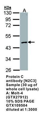 Protein C  antibody [N2C3], GeneTex