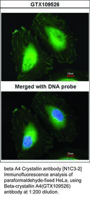 beta A4 Crystallin antibody [N1C3-2], GeneTex