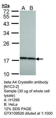 beta A4 Crystallin antibody [N1C3-2], GeneTex