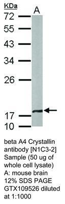 beta A4 Crystallin antibody [N1C3-2], GeneTex