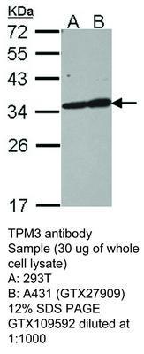 TPM3 antibody, GeneTex