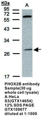 PHOX2B antibody - 100µl, GeneTex