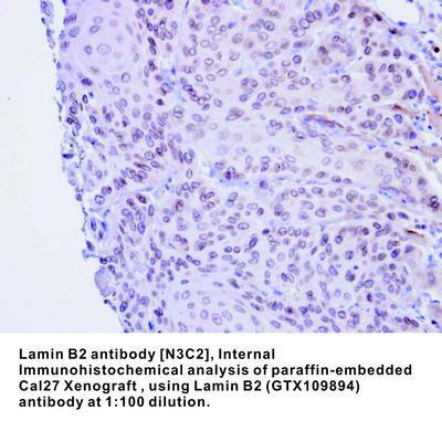 Lamin B2  antibody [N3C2], Internal, GeneTex