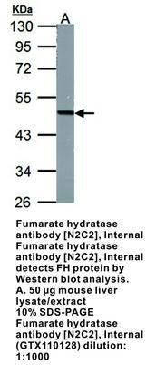 Fumarate hydratase antibody [N2C2], Internal, GeneTex