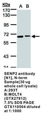 SENP2 antibody [N1], N-term, GeneTex