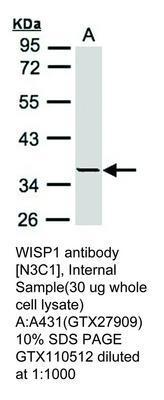 WISP1 antibody [N3C1], Internal, GeneTex