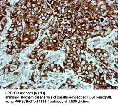 PPP3CB antibody [N1N3], GeneTex