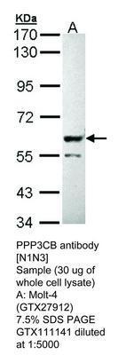 PPP3CB antibody [N1N3], GeneTex