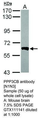 PPP3CB antibody [N1N3], GeneTex