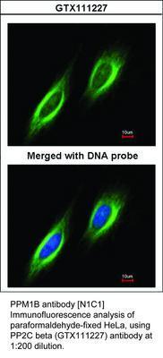 PPM1B antibody [N1C1], GeneTex