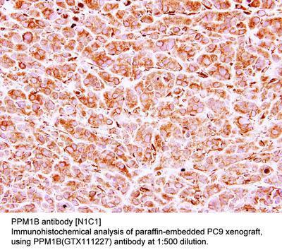 PPM1B antibody [N1C1], GeneTex