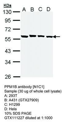 PPM1B antibody [N1C1], GeneTex