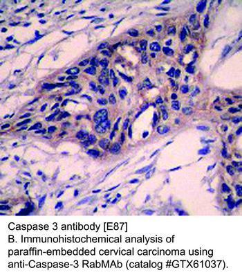 RB MAB TO CASPASE-3