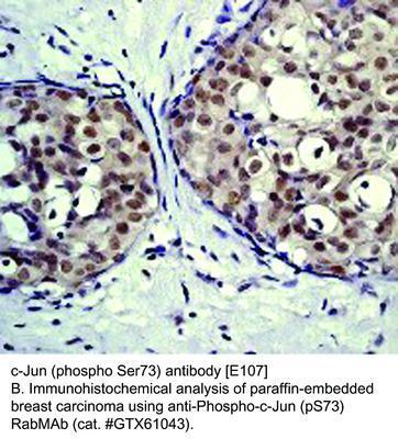 RB MAB TO C-JUN (PS73)