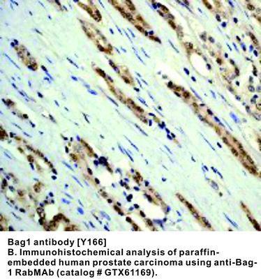 RB MAB TO BAG-1