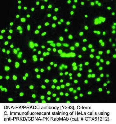 RB MAB TO DNA-PK/PRKDC