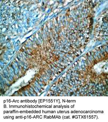 RB MAB TO P16-ARC