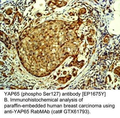 RB MAB TO YAP65 (PS127)