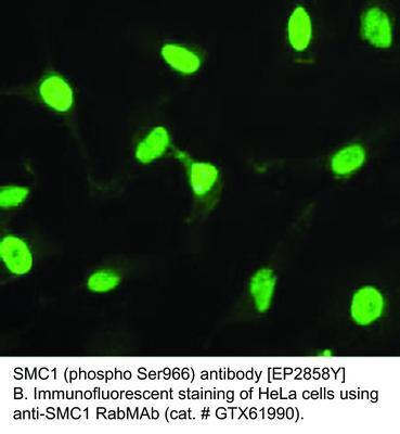 RB MAB TO SMC1 (PS966)