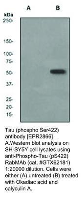 RB MAB TO TAU (PS422)