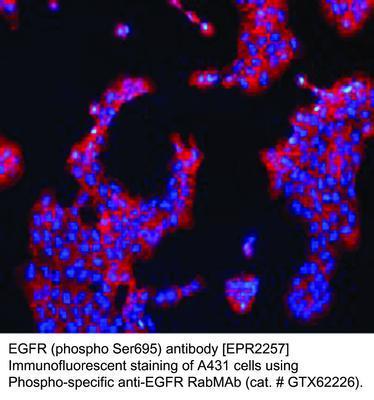 RB MAB TO EGFR (PS695)