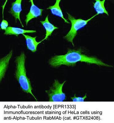 RB MAB TO ALPHA-TUBULIN