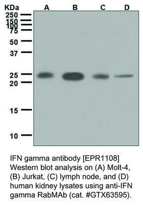 RB MAB TO IFN GAMMA