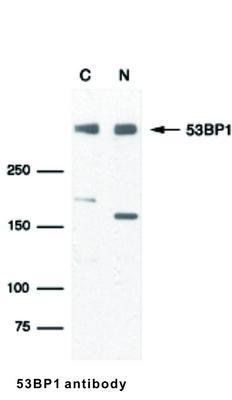 RB PAB TO 53BP1