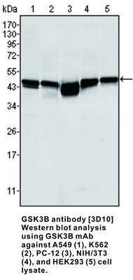 MS MAB TO GSK3B