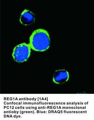 MS MAB TO REG1A