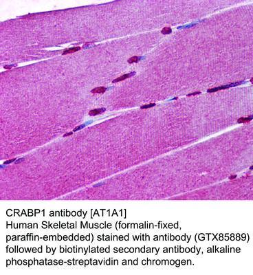 MS MAB TO CRABP1 [AT1A1]