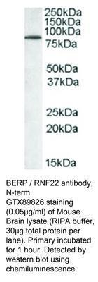 GT PAB TO BERP / RNF22