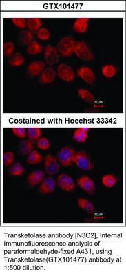 RB PAB TO TRANSKETOLASE