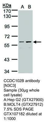 RB PAB TO CCDC102B