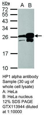 RB PAB TO HP1 ALPHA