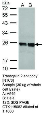 RB PAB TO TRANSGELIN 2