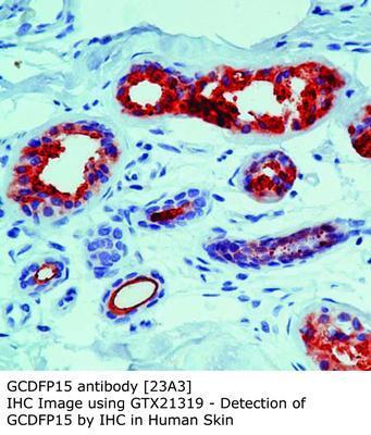 MS MAB TO GCDFP15