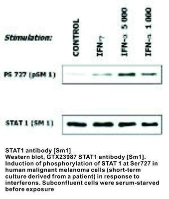 MS MAB TO STAT1