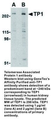 RB PAB TO TELOMERASE ASSO PROT