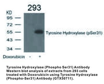 RB PAB TO TYROSINE HYDROX S31