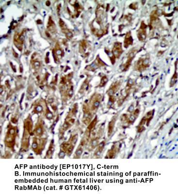 AFP antibody [EP1017Y], C-term, GeneTex