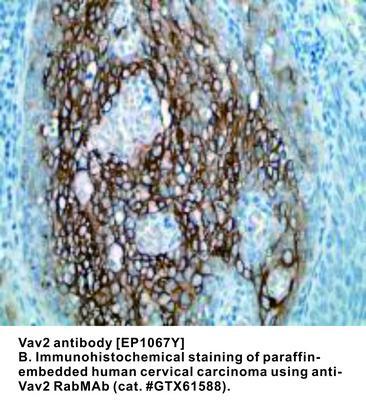 RB MAB TO VAV2