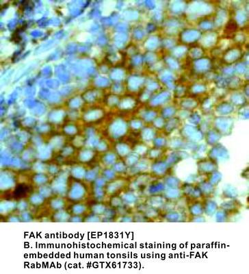 FAK antibody [EP1831Y], GeneTex