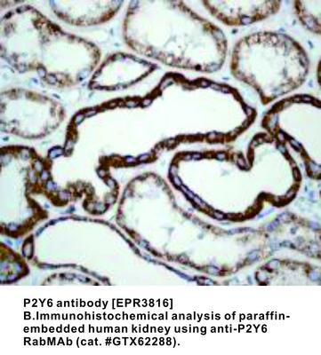 RB MAB TO P2Y6