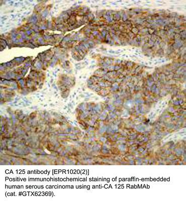 RB MAB TO CA 125